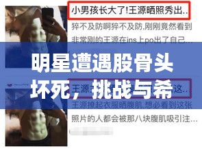明星遭遇股骨头坏死，挑战与希望同行