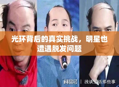 光环背后的真实挑战，明星也遭遇脱发问题