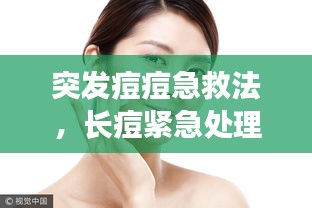 突发痘痘急救法，长痘紧急处理 
