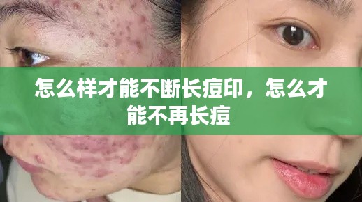 怎么样才能不断长痘印，怎么才能不再长痘 