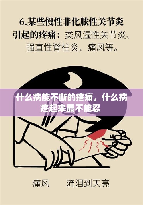 什么病能不断的疼痛，什么病疼起来最不能忍 
