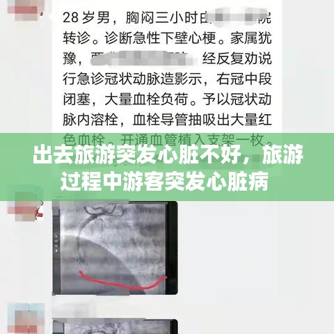 出去旅游突发心脏不好，旅游过程中游客突发心脏病 